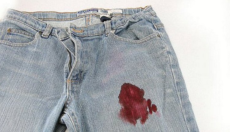 Кровь на одежде