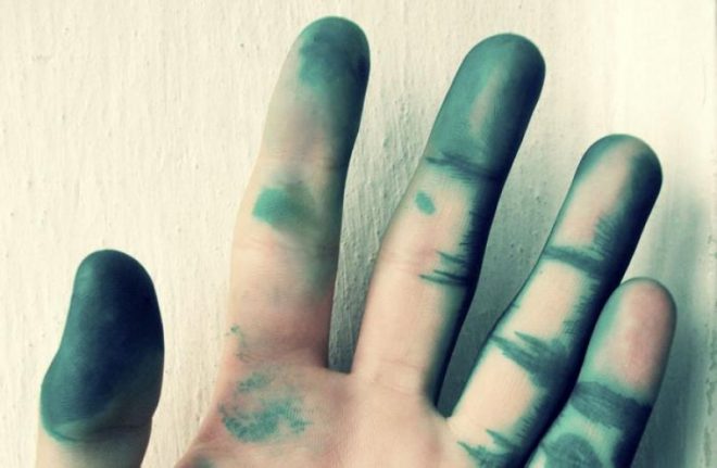 Как отмыть зеленку с кожи рук